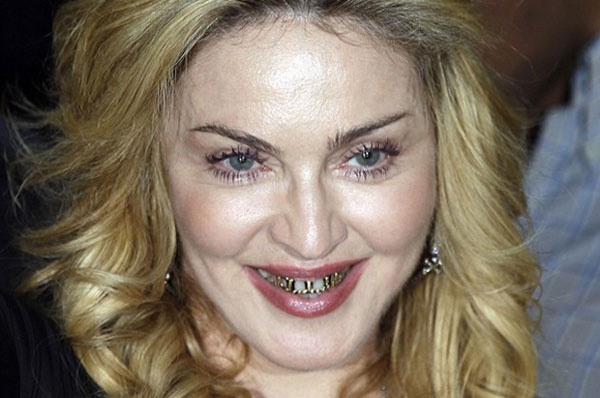 Madonna'nın altın dişleri korkunç!