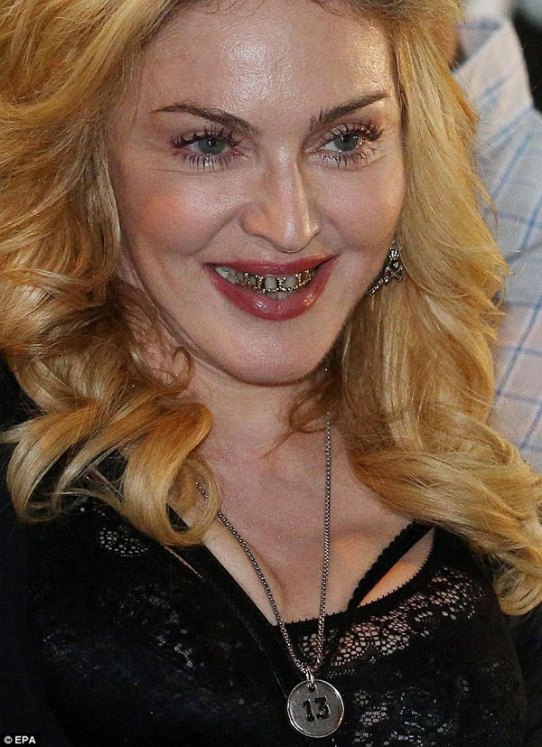 Madonna'nın altın dişleri korkunç!