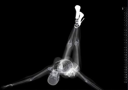 'Erotik röntgen' takvimi güzelleri