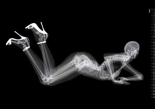 'Erotik röntgen' takvimi güzelleri