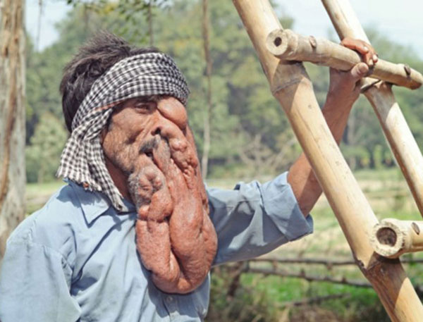 Hindistan'ın Fil Adamı Chana Lal