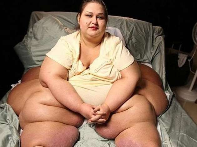 362 kilo veren kadın