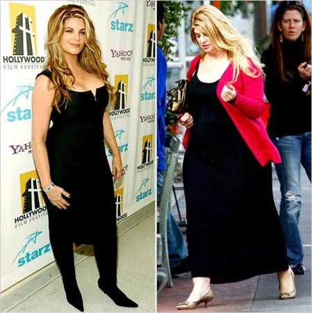 Kristie Alley bu hale geldi