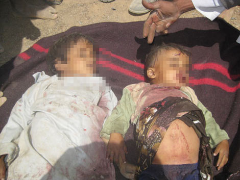 Yemen'den korkunç katliam kareleri