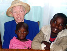Albino Afrikalılar ölüm korkusuyla yaşıyor