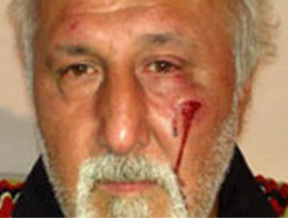 AK Parti'li başkan önce dövüldü sonra dövdü