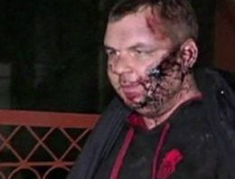 Ukraynalı muhalif Bulatov'a işkence yapılmış