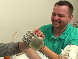 'Hissedebilen' protez el hayali gerçek oldu