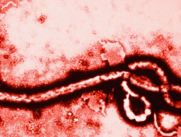 Ebola nasıl bulaşır virüsün belirtileri neler?