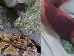 Çıngıraklı yılanla selfie bu hale getirdi