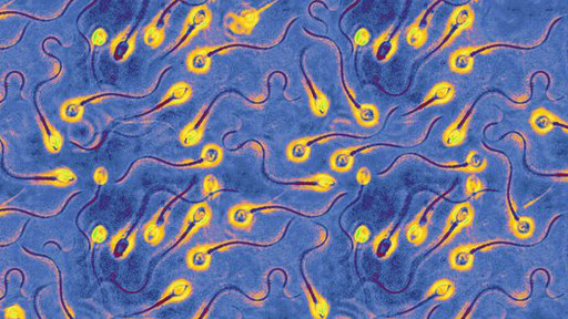131203175851_sperm_512x288_bbc_nocredit.jpg