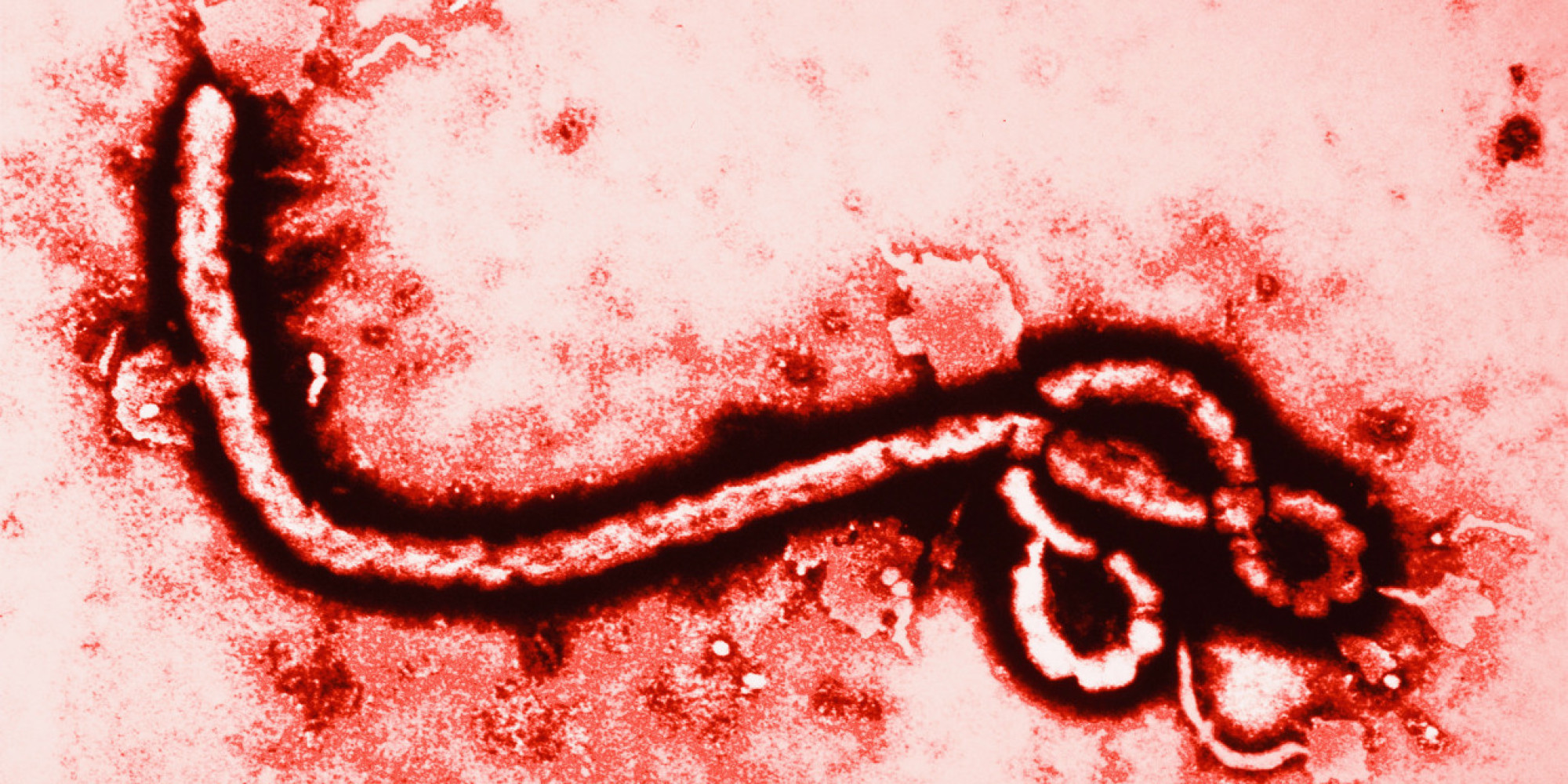 ebola-virüsü-nedir.20141016132139.jpg