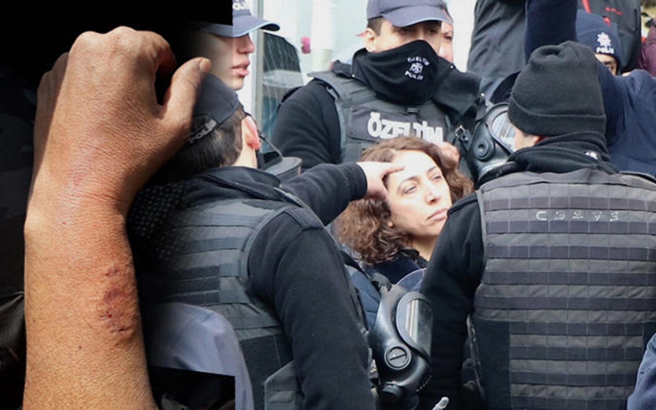 HDP'li milletvekili Saliha Aydeniz, polis memurunun kolunu ısırdı