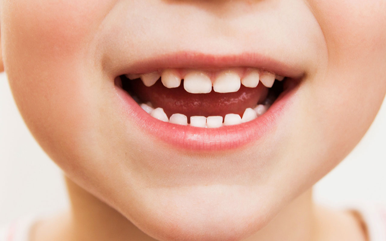 Çocuklardaki diş çürüklerinin sebepleri