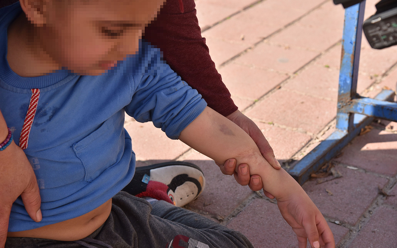 Antalya'da 5 yaşındaki zihinsel engelli çocuğa okulda şiddet