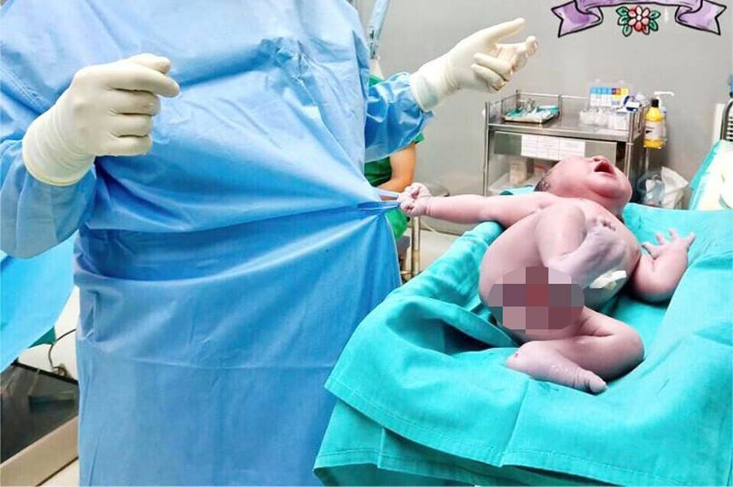 Yeni doğan bebeğin yaptığı hareket sosyal medyayı salladı.