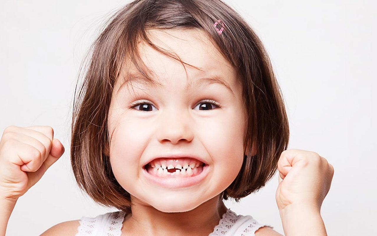 Çocukların çürük süt dişleri çekilmeli mi?