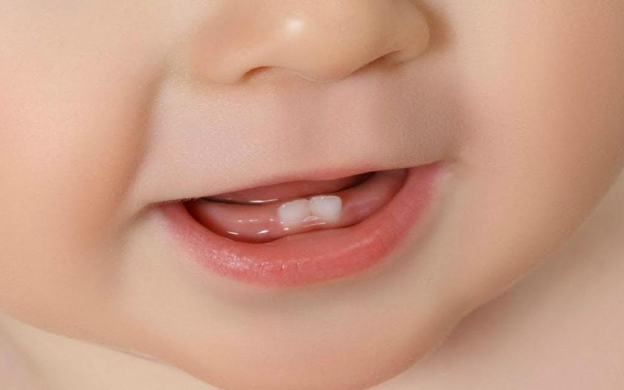Süt dişlerinin çürüyüp erken çekilmesi halinde ne yapılması gerekir?