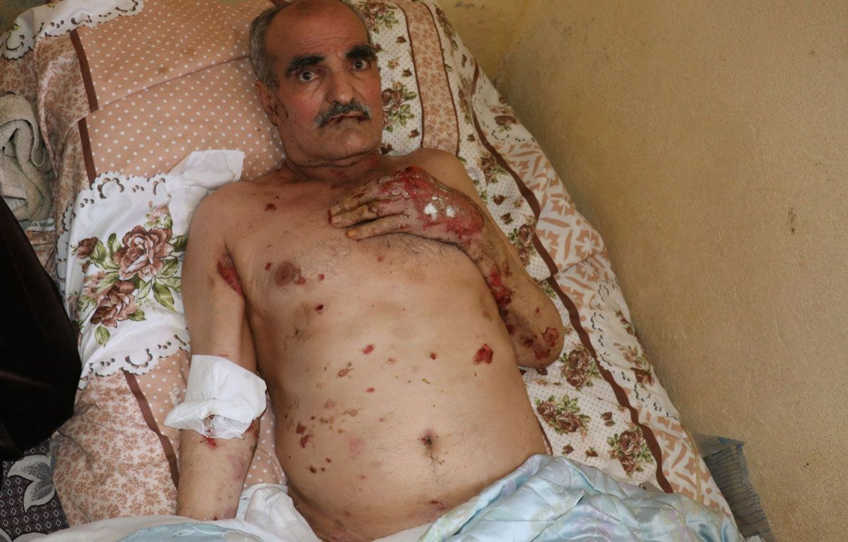 Vücudunu ve ağzının içini saran yaralar kabusu oldu! Suriyeli adamın yürek yakan feryadı