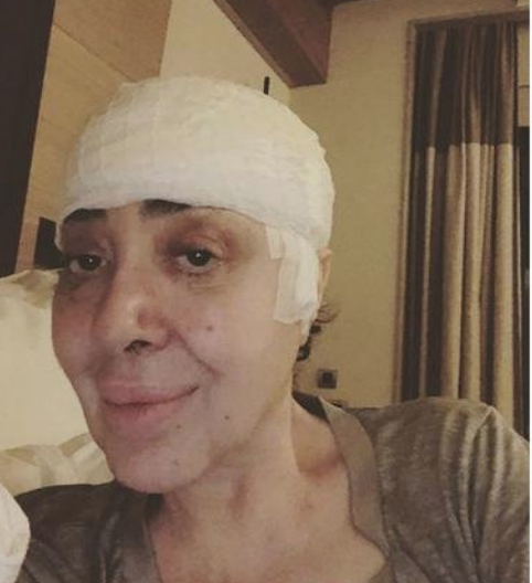 Nur Yerlitaş gizlice ameliyat oldu son görüntüsü korkuttu