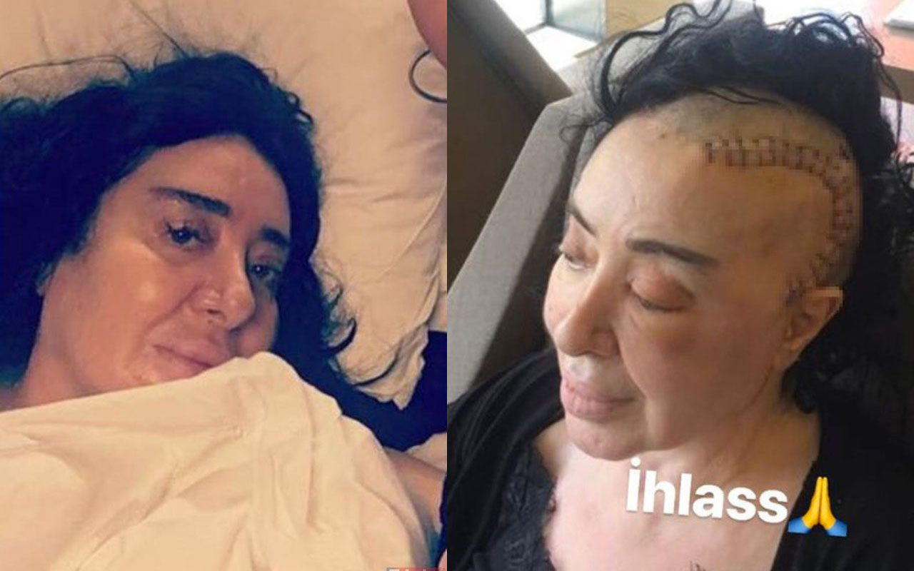 Nur Yerlitaş gizlice ameliyat oldu son görüntüsü korkuttu