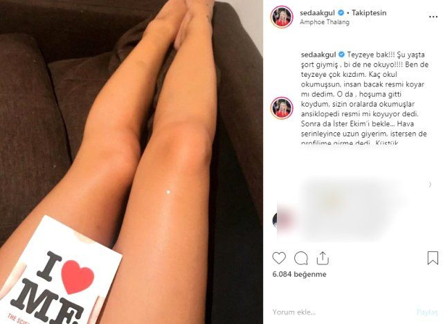 Seda Akgül paylaştığı bacak fotoğrafıyla olay oldu