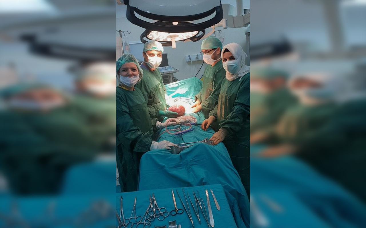 Şanlıurfa'da hastanın karnından 3 kiloluk kist çıktı