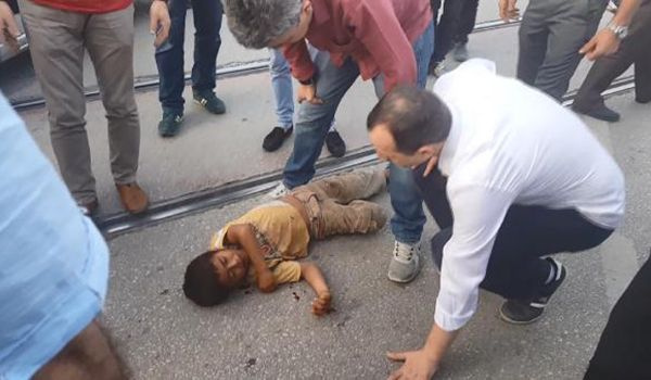 Bursa'da oğlu kaza geçiren babanın hareketleri şaşırttı