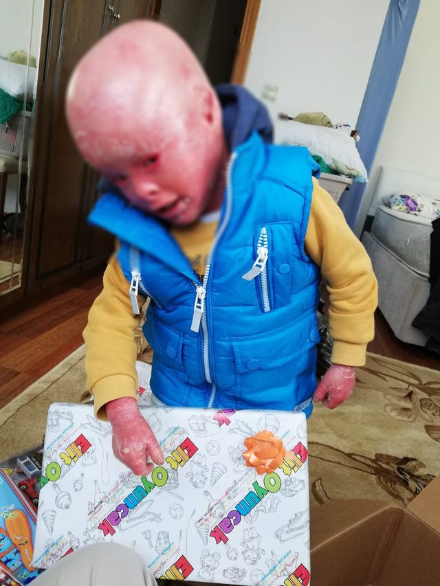 Haluk Levent mutlu haberi verdi! Balık pulu hastası olan Küçük Emir için umut oldu