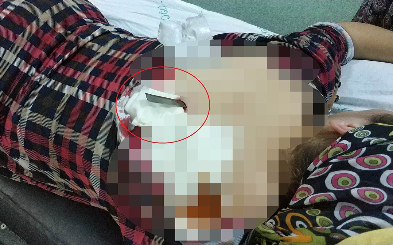 Samsun'da bir kadın sırtına saplanan bıçakla hastaneye kaldırıldı