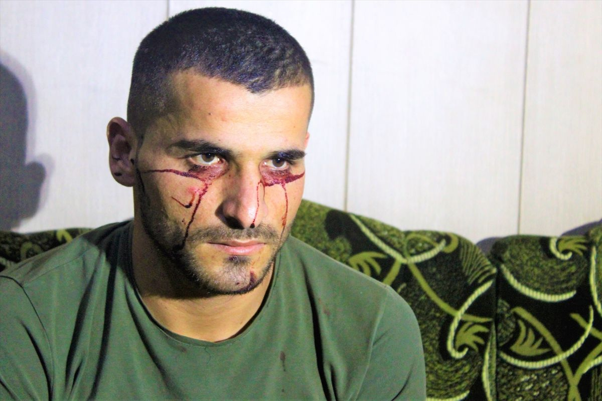 Iraklı genç kan ağlıyor! Hastalığına çare bulunamadı Türkiye'den yardım istedi