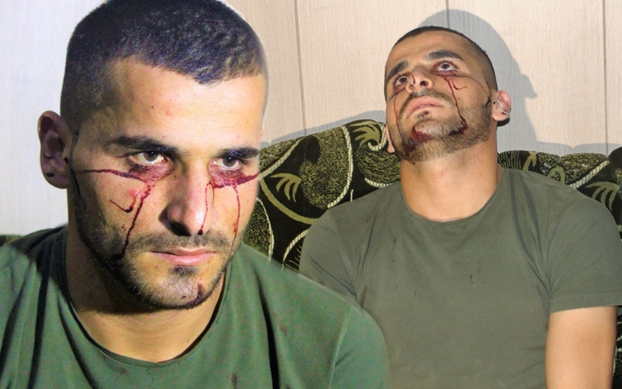Iraklı genç kan ağlıyor! Hastalığına çare bulunamadı Türkiye'den yardım istedi
