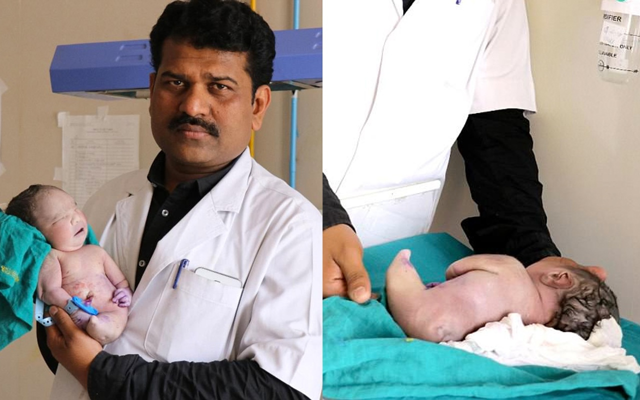 Hindistan'da doğan garip bebek doktorlar cinsiyetini tespit edemedi