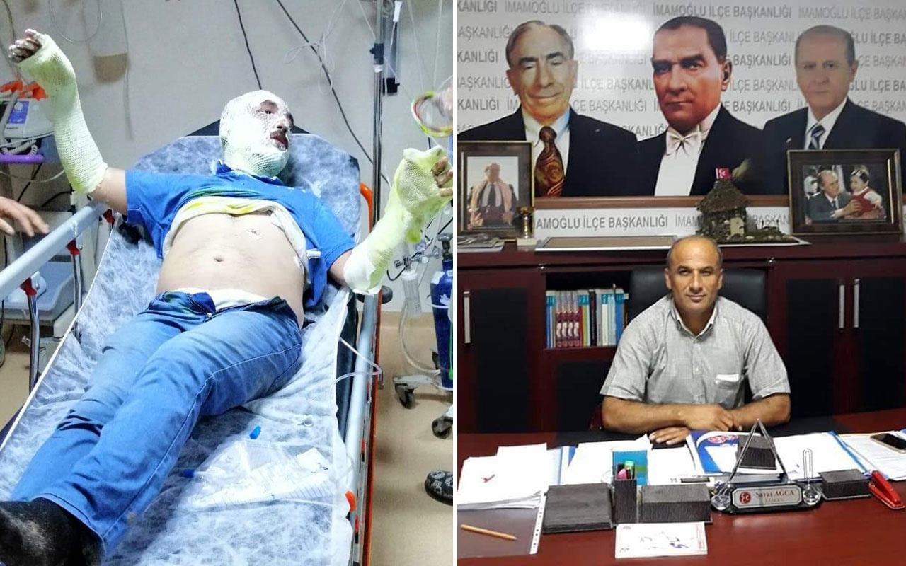MHP İlçe Başkanı teknede çıkan yangında yaralandı