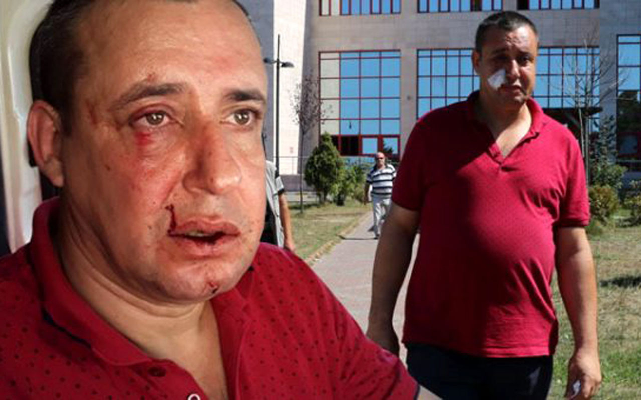 Yer Zonguldak! Belediye işçilerinden terörle mücadele gazisine asfalt dayağı