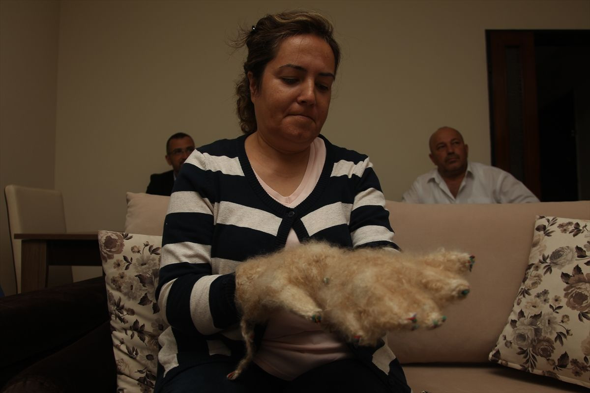 Savcı Sayan'dan raynaud fenomeni hastası Seval Taşdan'a tiftik eldiven