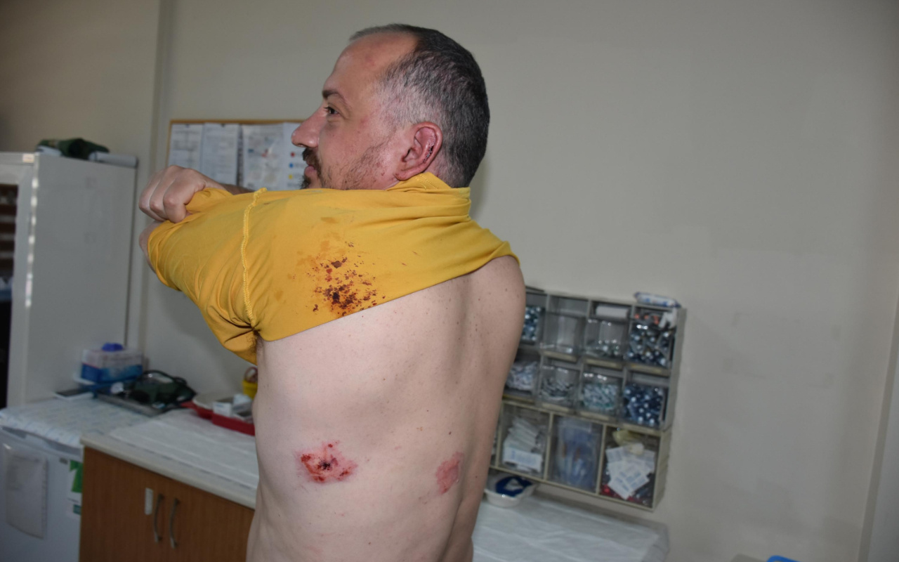 Ünlü gezgin Fatih Koparan'ı feci dövdüler : Beni öldürecekler