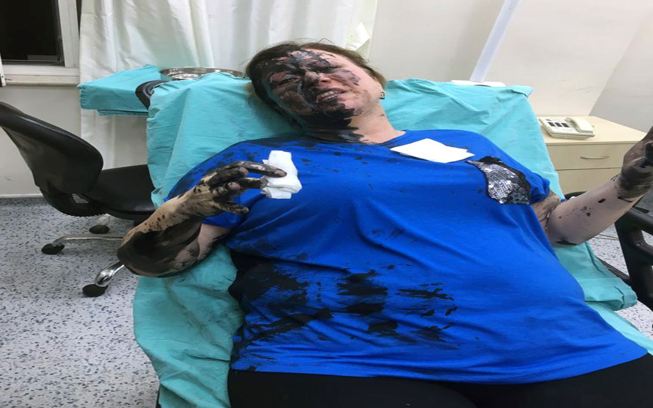 Adana'da bir kadını darbedip üzerine siyah renkli sıvı madde döktüler