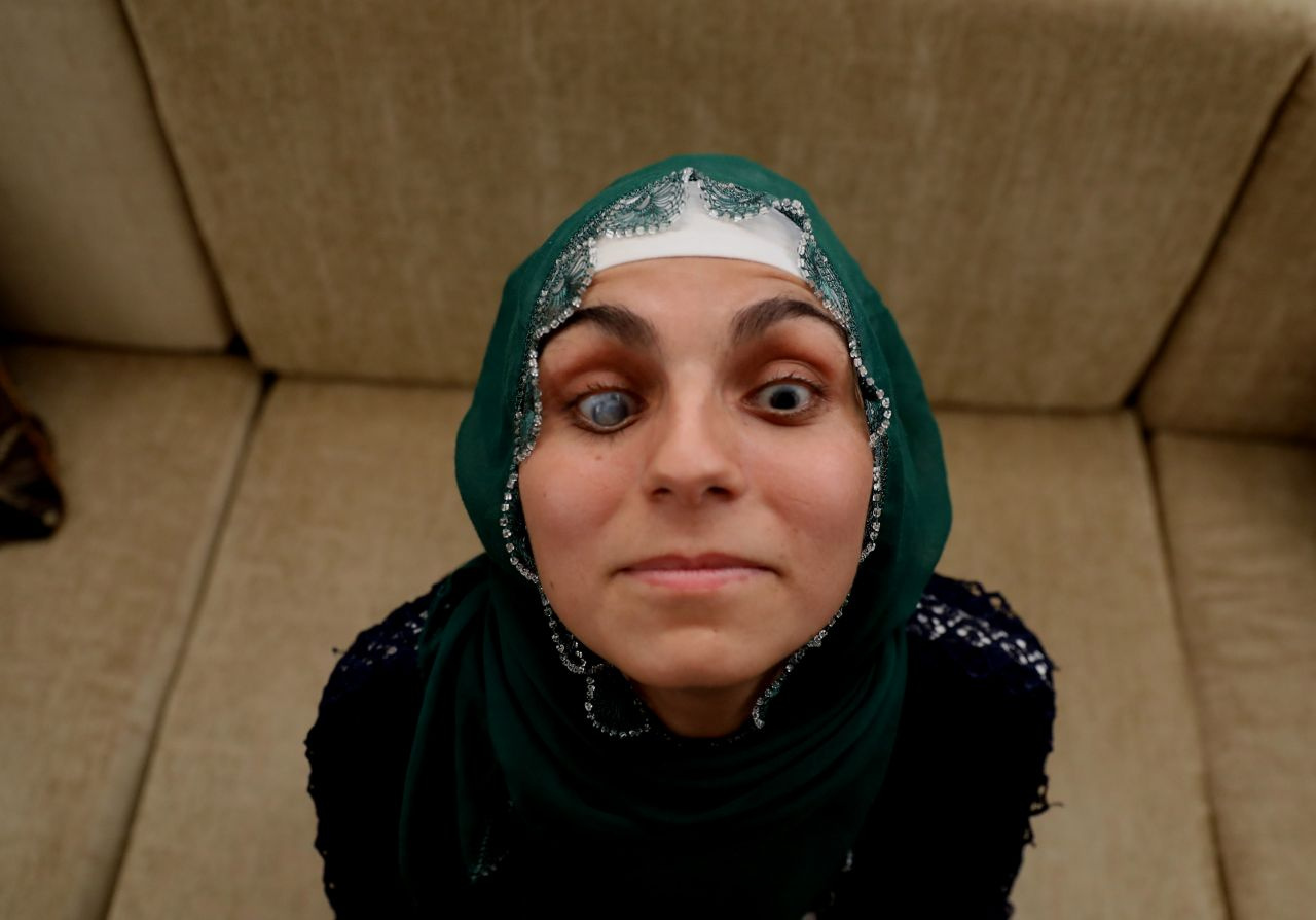 21 yaşındaki Ayşe Acar kendini ilk kez aynada gördü