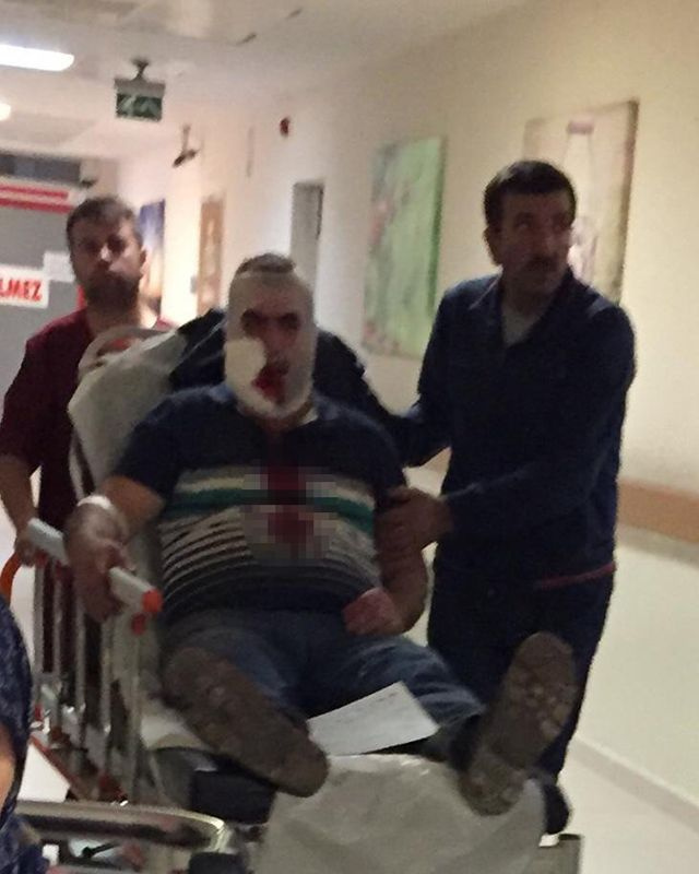 Bursa'da vincin kancası yüzüne çarpan işçi ağır yaralandı