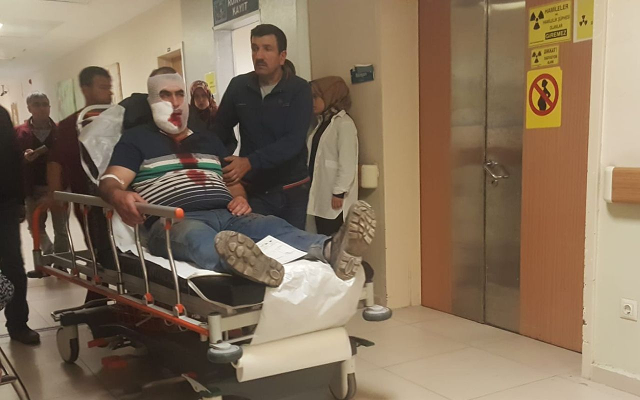 Bursa'da vincin kancası yüzüne çarpan işçi ağır yaralandı