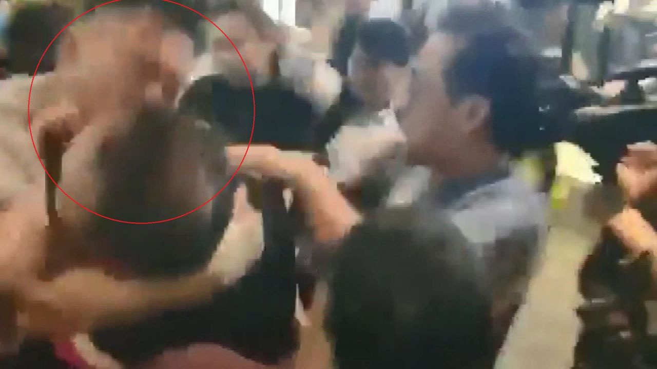 Hong Kong’da meclis üyesinin kulağı ısırılarak koparıldı