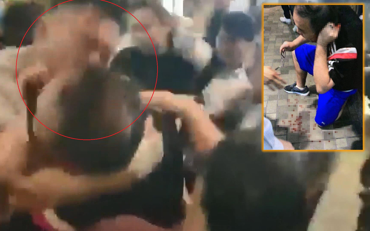 Hong Kong’da meclis üyesinin kulağı ısırılarak koparıldı