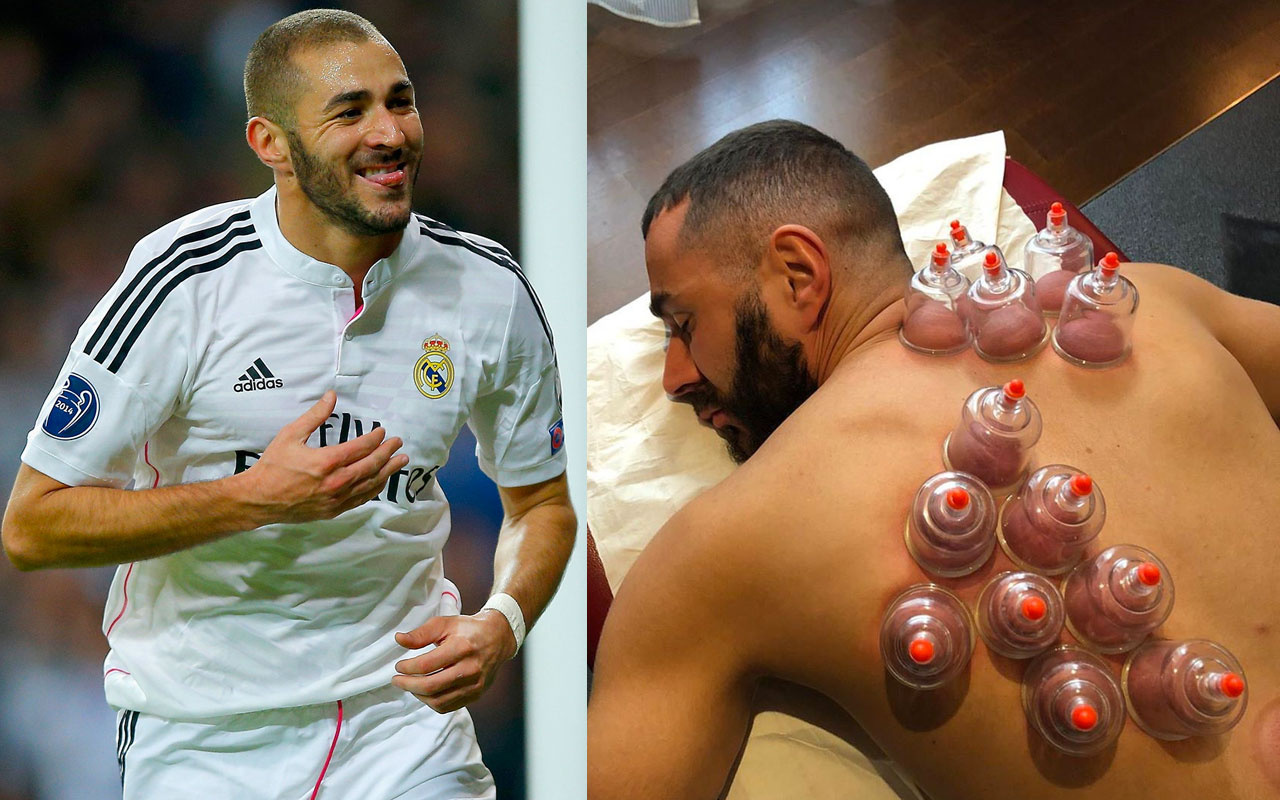 Karim Benzema hacamat yaptırdı “iyileşme” notunu düştü