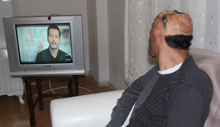 Kafatası yok beyni dışarıda Mehmet Ali'nin çığlığı