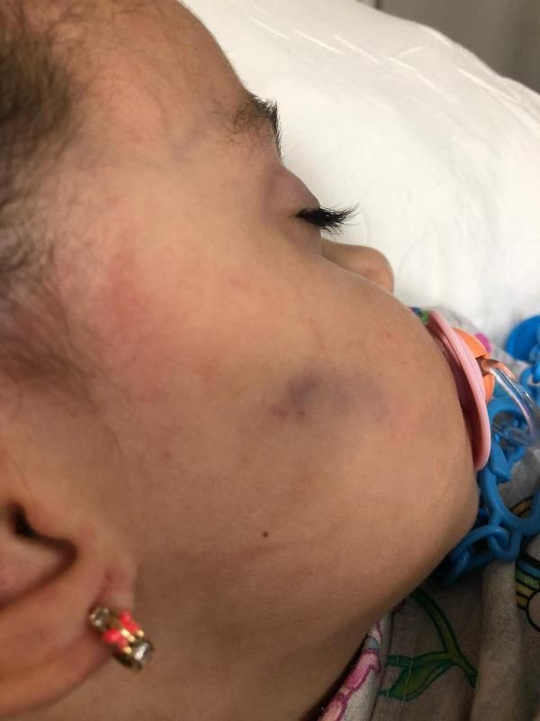 İzmir'de 2,5 yaşındaki kız çocuğu anaokulunda yaşıtları tarafından dövüldü