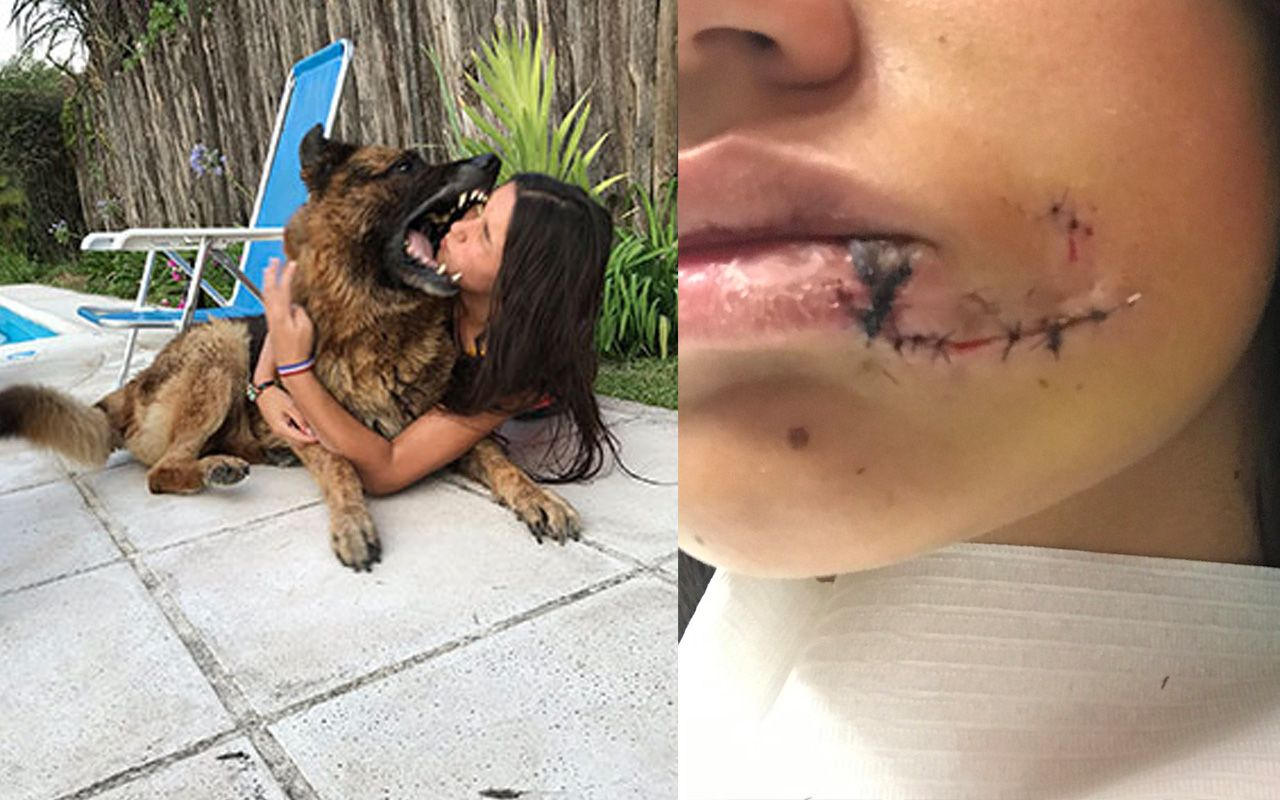 Köpekle selfie çekecekti hayatının şokunu yaşadı! Son hali dehşete düşürdü