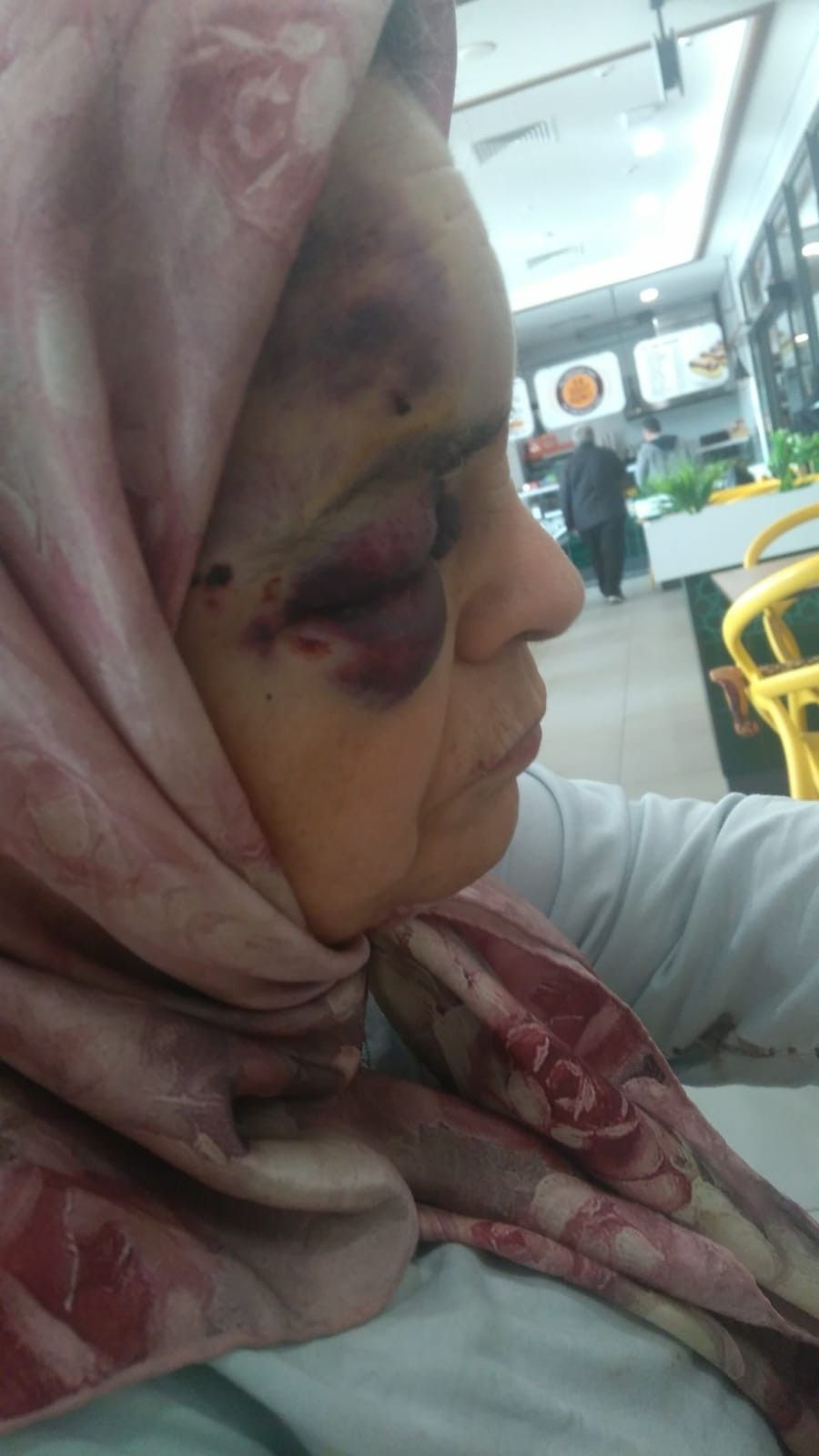 Bursa’da park yüzünden çıkan kavgada yaşlı çifti öldüresiye dövüldü
