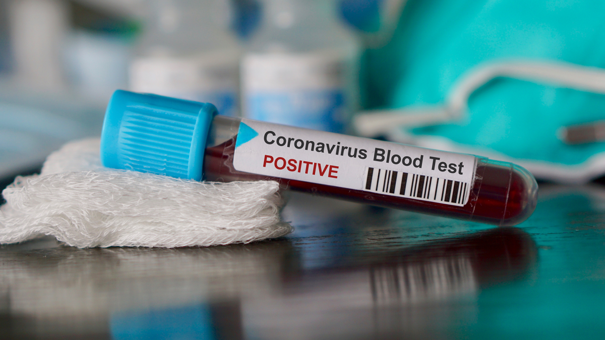 Koronavirüs Türkiye'de de görüldü ilk hastanın ardından Sağlık Bakanlığı 14 gün kuralını hatırlattı