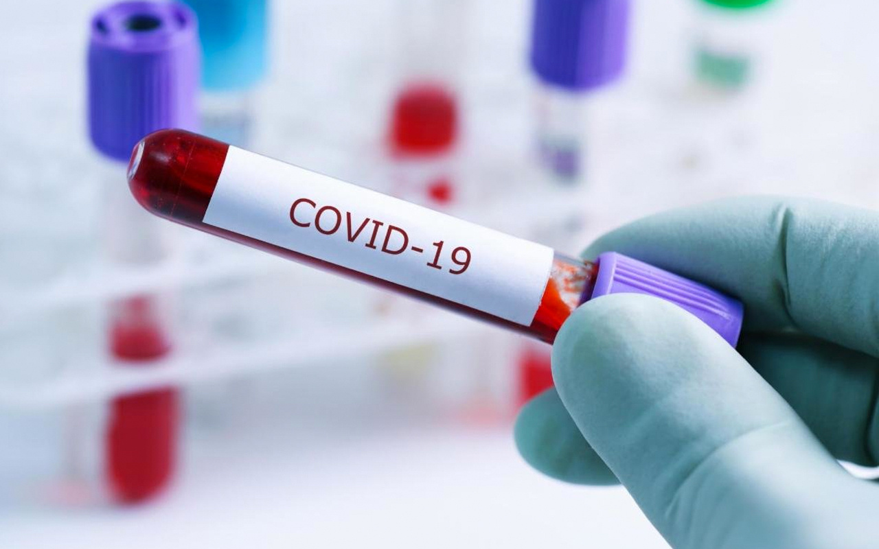 Gripten öldüğü düşünülen bazı kişilerde koronavirüs bulundu